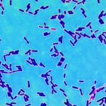 Los Halófilos y su Importancia en los Ecosistemas Extremos